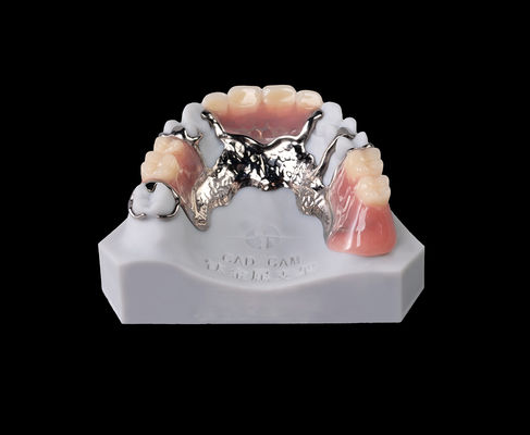 Cobalt Chromium Metal Frame Dental Co-Cr Dentures yang bisa dilepas