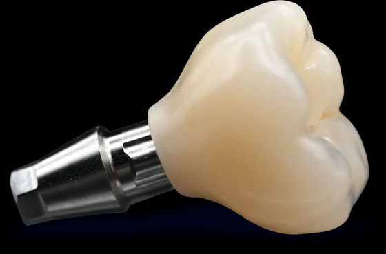 Beli CAD / CAM Implantasi Crown Bridge Estetika Tinggi Zirconia Crown online manufacture