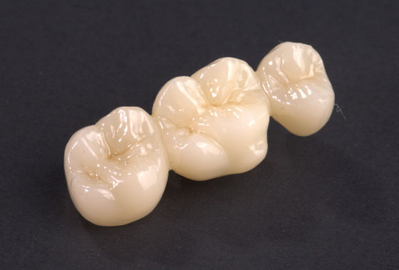 Beli Jembatan Zirconia Jembatan Zirconia Crown Jembatan Tinggi Kekuatan online manufacture