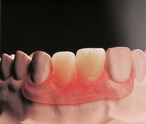 Beli Flexible Flipper Removable Dentures Clinical Removable Partial Prosthodontics online manufacture