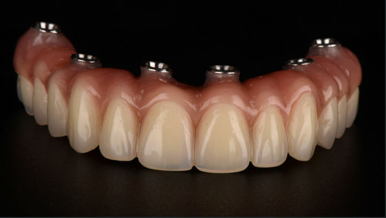 Beli All On X Implant Dentures Titanium Bridge Dental CE FDA persetujuan online manufacture