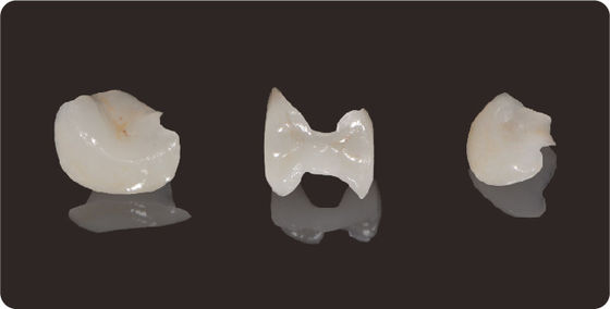 Beli Keakuratan Inlay Gigi Dan Onlays Litium Disilikat Milling Onlay Veneer online manufacture