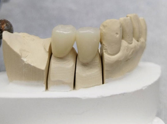 Beli Customized Dental Temporary Crown PMMA Temporary Bridge dan Crown online manufacture
