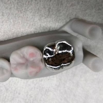 Beli Full Metal Crown And Bridge Keakuratan Tinggi Perak Temporary Crown online manufacture