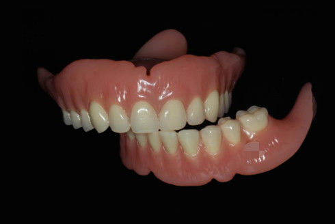 Beli Dental lengkap dicetak digital lengkap gigi merah muda online manufacture