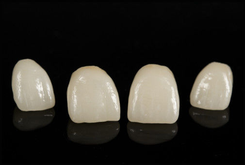 Beli Porselen CAD/CAM Digabungkan dengan Jembatan Zirconia Untuk Memulihkan Penampilan Alami online manufacture