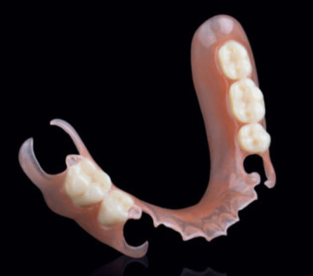 Beli Valplast Fleksibel Parsial Removable Dentures Precision Attachment Dalam Prosthodontics online manufacture