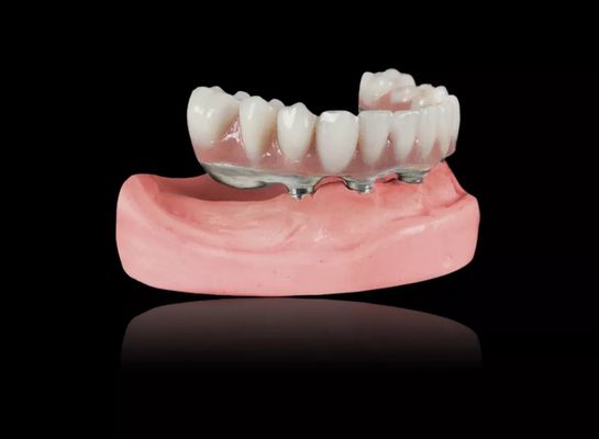 Beli Implantasi Titanium Bar Gigi yang bisa dilepas Titanium Alloy Implantasi Bar Overdenture online manufacture
