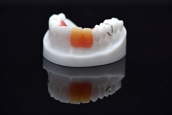 Beli Acrylic Flipper Removable Overdenture Customized Removable Acrylic Denture online manufacture