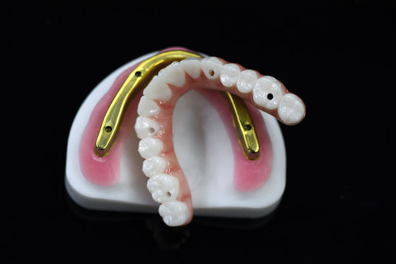 Beli Jembatan Zirconia Gigi yang dapat disesuaikan di atas batang implan yang digiling Keakuratan tinggi online manufacture