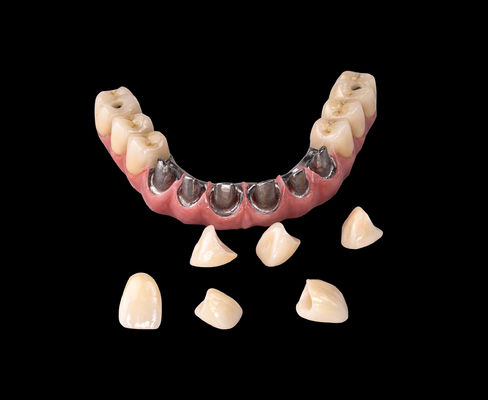 Beli Semua pada X Implan Titanium Jembatan Dental Hanya Kerangka Profesional online manufacture