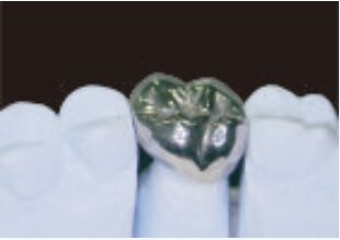 Beli Full Metal Crown And Bridge Keakuratan Tinggi Perak Temporary Crown online manufacture