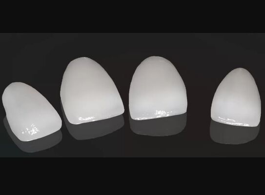 Beli Estetika Tinggi Komposit Mahkota Onlay Veneer Ukuran yang dapat disesuaikan online manufacture