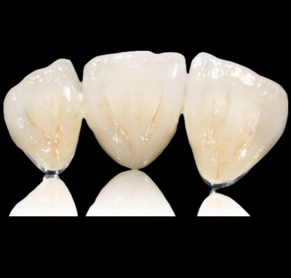 Beli Customisable Semi Permata Mahkota Atau Jembatan Permata Alloy Mahkota Dan Jembatan online manufacture