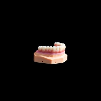 Beli Ti Base Crown Implant Titanium Crown / Bridge Coping With Composite online manufacture