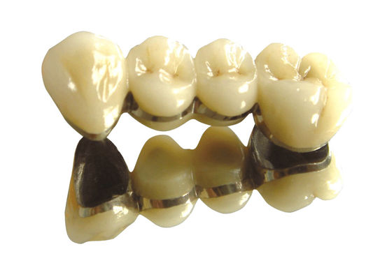 Warna Gigi Kobalt Kromium Crown PFM Dental PFM Tinggi