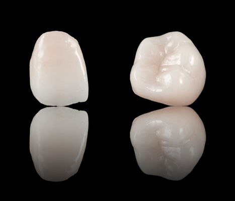 Estetika Tinggi Full Contour Crown Dental Zirconia Bridge CE Dan FDA persetujuan