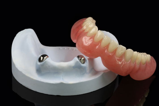 Telescope removable dentures Precision Attachment Overdenture Arylic