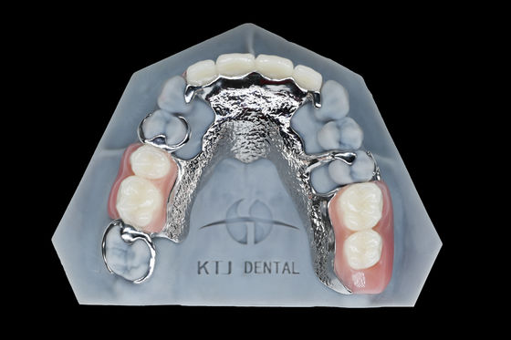 Titanium rangka logam gigi palsu removable gigi palsu Custom