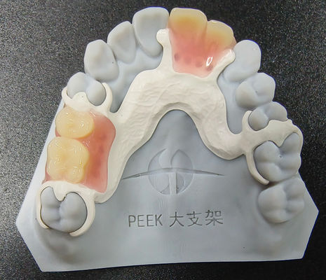 Peek yang dapat disesuaikan Denture yang bisa dilepas Kerangka parsial ketahanan aus