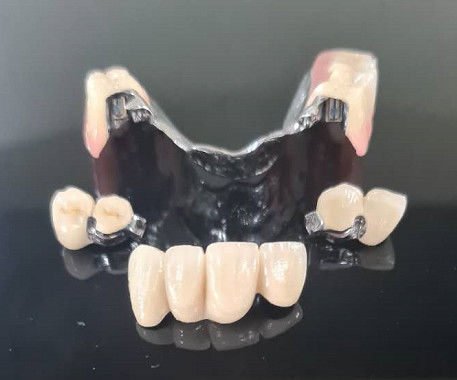 Kerangka logam Precision Attachment Overdenture Dental removable Denture