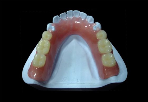 Pink Removable Acrylic Partial Denture Temporary Acrylic Partial Denture