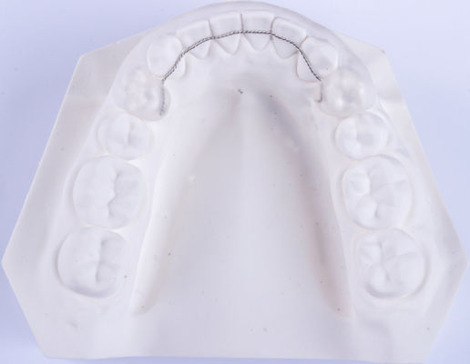 Tongue Wire Retainer Orthodontics Retainers untuk meluruskan gigi