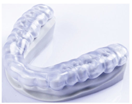 Perlindung Oklusal Jelas Hard Appliance Hard Night Guard Untuk Menggiling Gigi