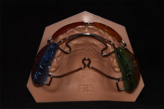 Frankel III Malocclusion Ortodontik Alat Fungsional Profesional