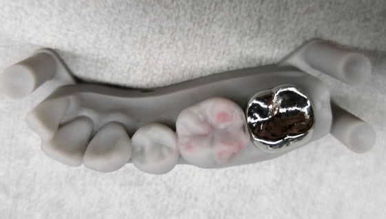Full Metal Non Precious Crown Implant PFM Crown And Bridge Profesional