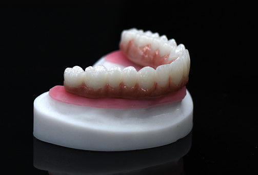 Full Arch Zirconia Hybrid Bridge Zirconia Crown Bridge Disesuaikan