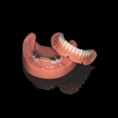Pink Titanium Bar Removable Dentures Dengan Akrilik Denture Finish