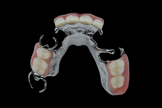 Dentitas yang dapat disesuaikan Dentitas yang bisa dilepas Kerangka Titanium Kerangka logam gigi