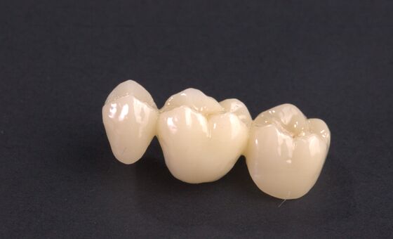 Customized Dental Temporary Crown PMMA Temporary Bridge dan Crown